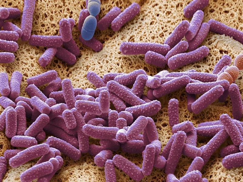 бактерия Пастерелла