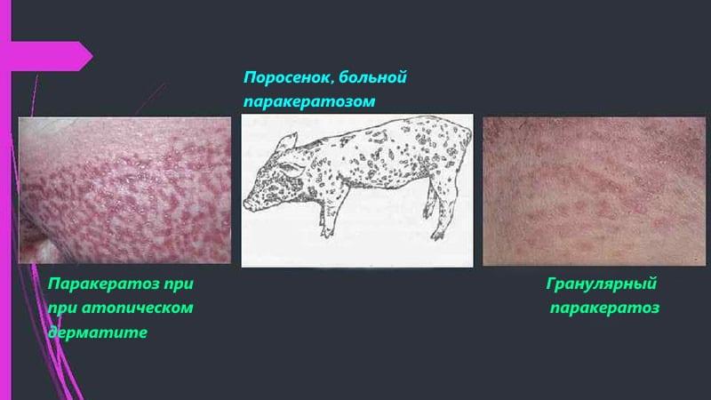 диагностирование паракератоза у свиней