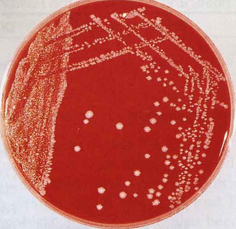возбудитель заболевания бактерия пастерелла